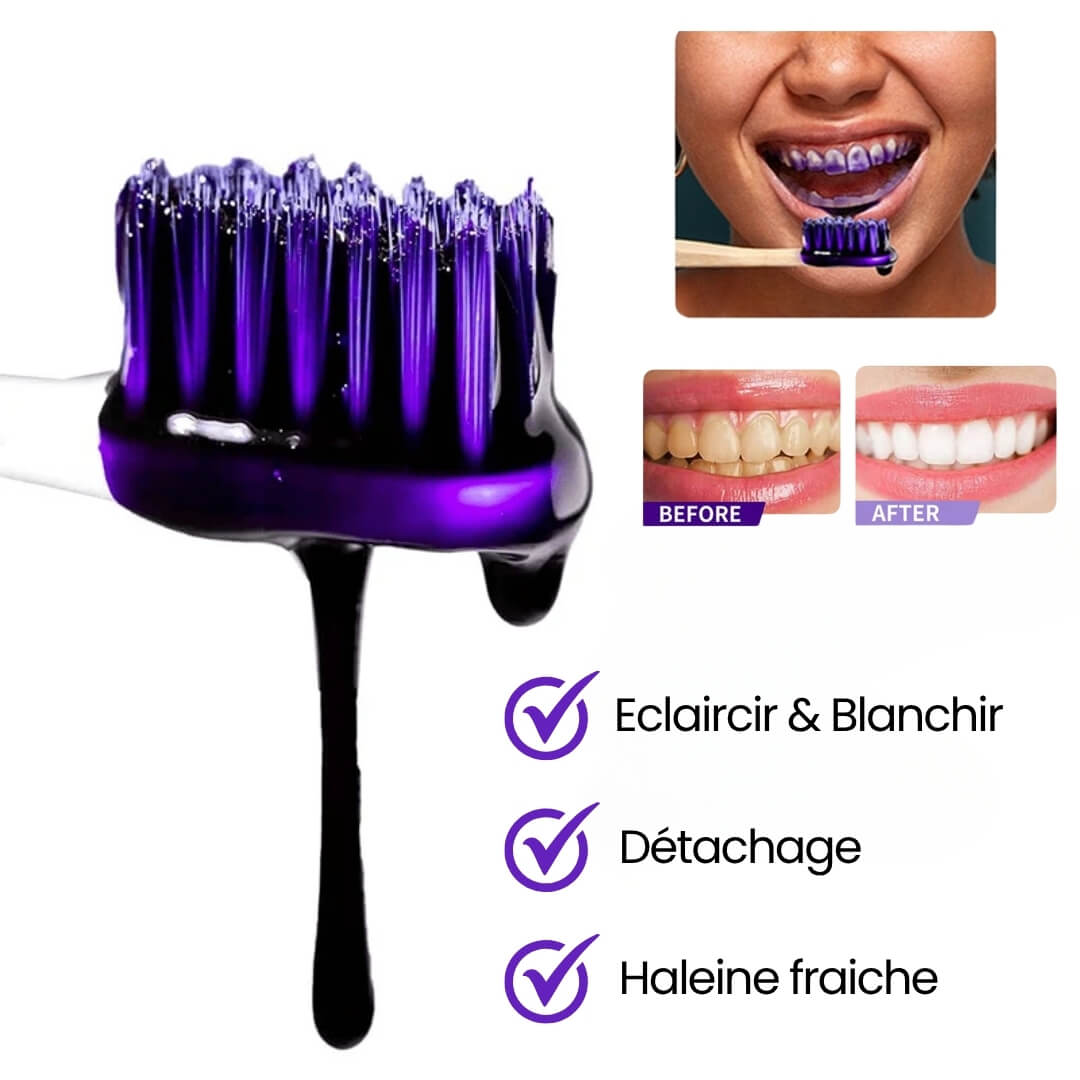 Smilekit | V34 Dentifrice Violet 🦷