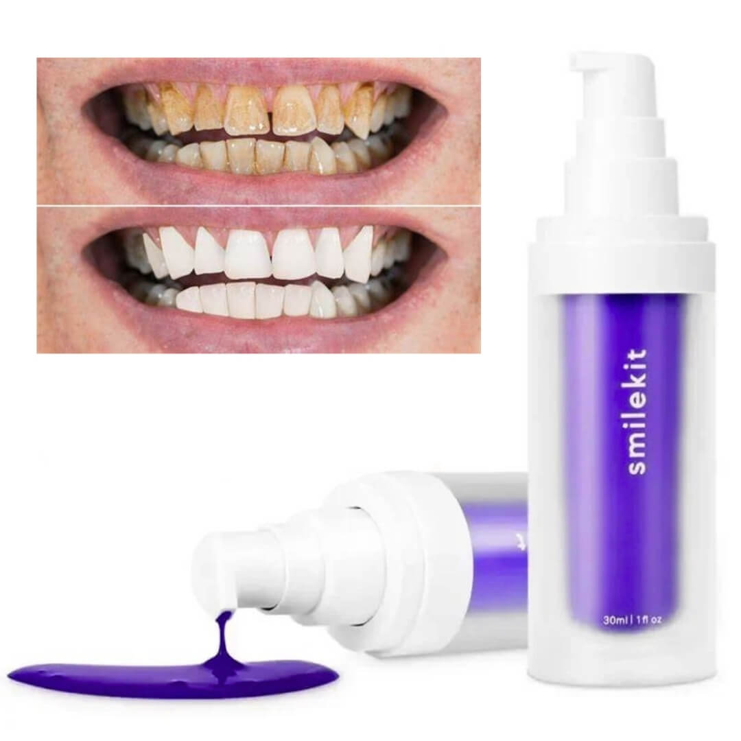 Smilekit | V34 Dentifrice Violet 🦷